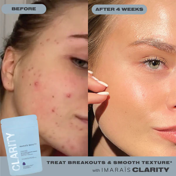 Imarais Beauty Clarity Supplement 30 pack